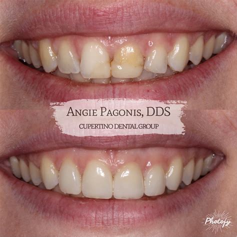 ANGIE PAGONIS, DDS